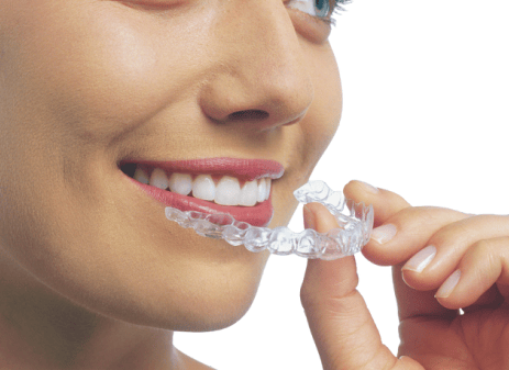 Invisalign, aligner invisibles, Dre Isabelle Baillargeon orthodontiste