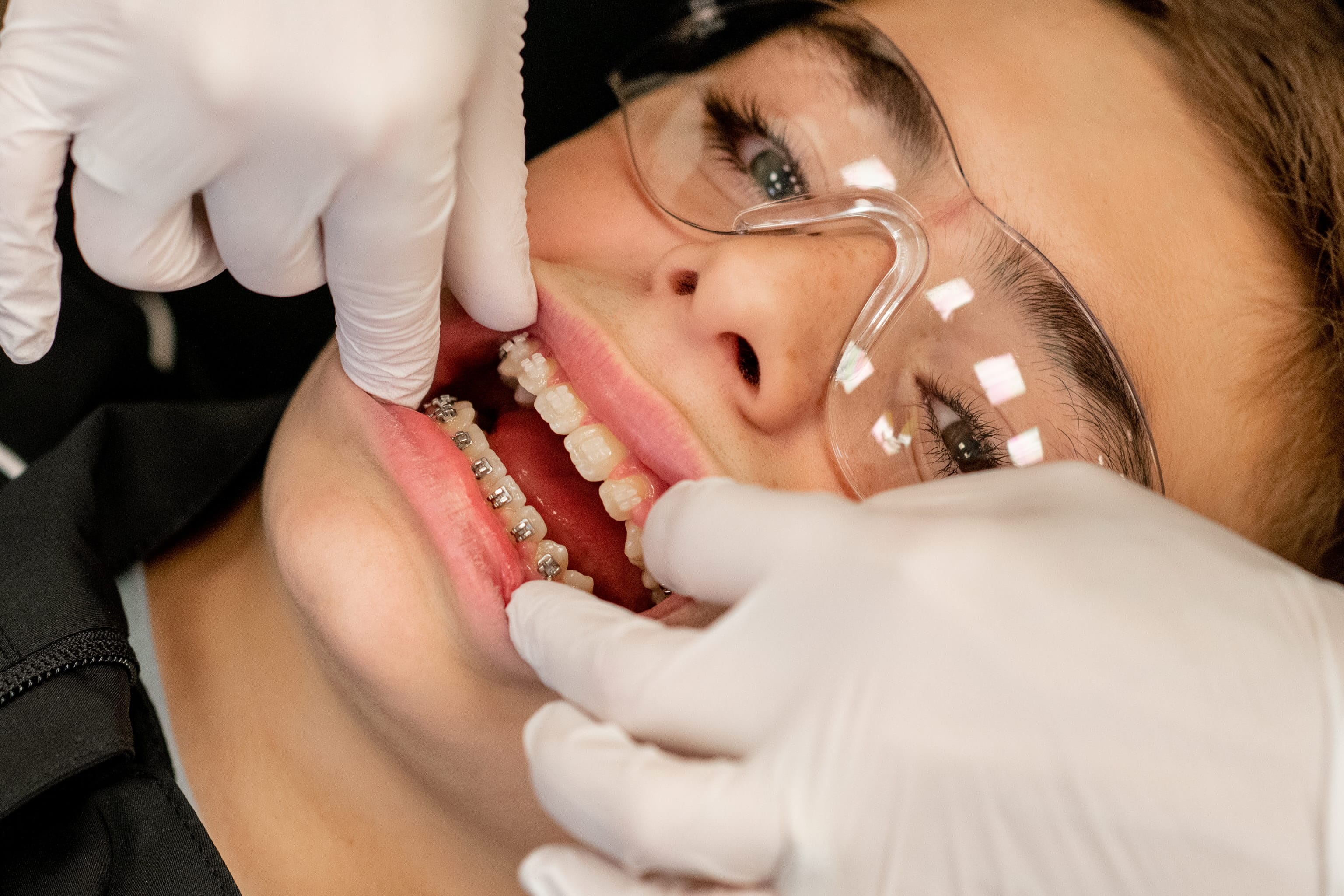 Examen, traitement avec boitier orthodontique